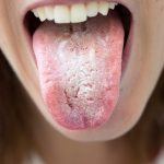 Descubre el significado de la lengua blanca